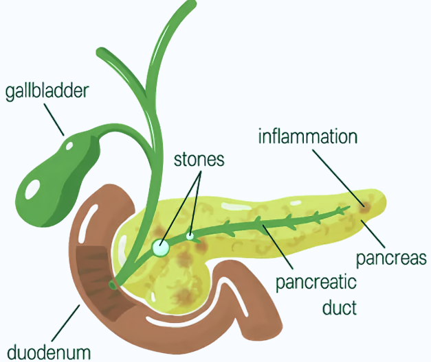 Pancragen: A Beneficial Aid for Pancreatic Health