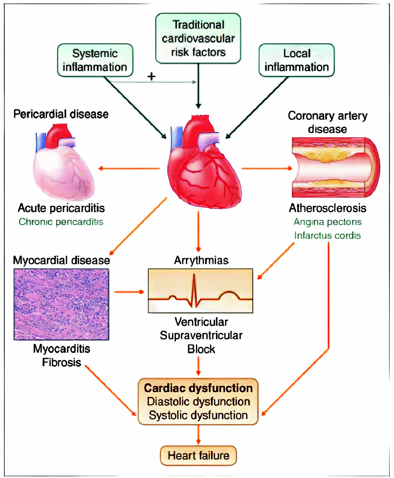 Corgaten: A Powerful Tool for Protecting Cardiac Function in Heart Failure Patients